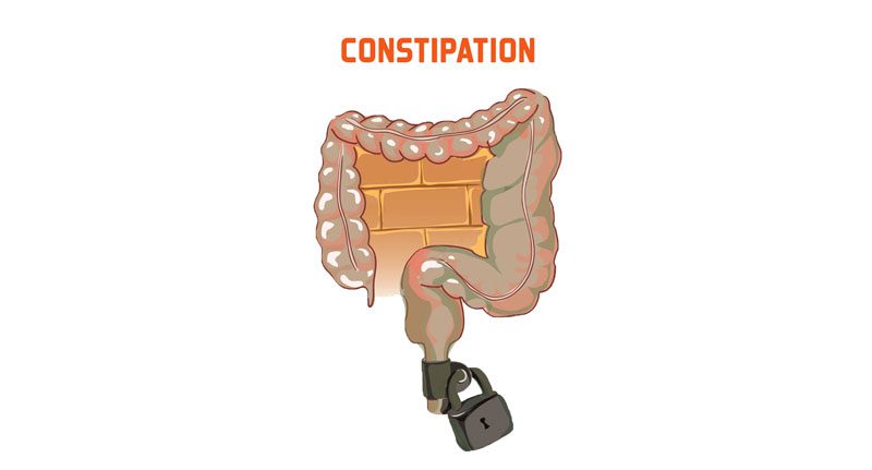 یبوست چیست؟