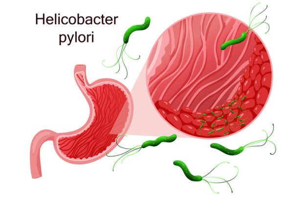 عفونت هلیکوباکتر پیلوری چیست؟
